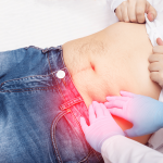 Fisioterapia suelo pélvico en Santa Pola