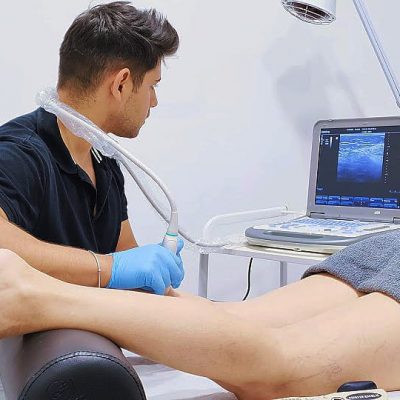 Fisioterapia deportiva en Santa Pola